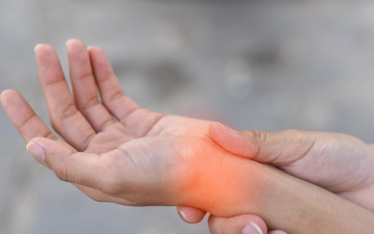 Artritis Reumatoide