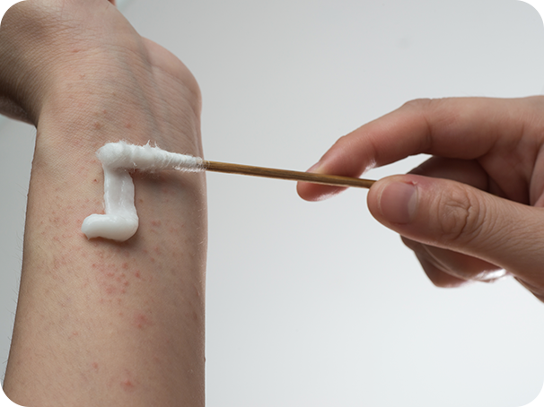 Prevención y tratamiento dermatitis