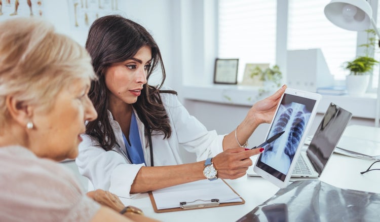 ¿A qué médico debes asistir ante un diagnóstico de cáncer de pulmón?