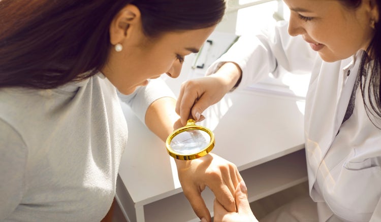 ¿Cómo prevenir el cáncer de piel (melanoma)?