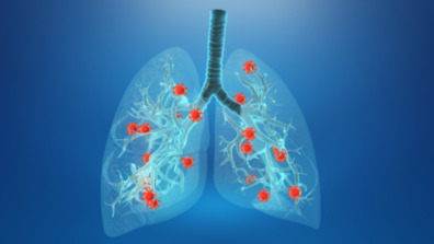 Enfermedades respiratorias