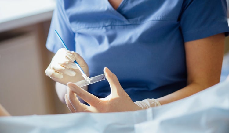 ¿Cuál es la diferencia entre el examen de Papanicolaou y la prueba de VPH?