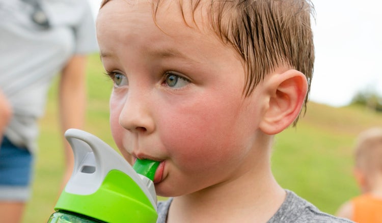 ¿Cómo identificar un golpe de calor en niños?