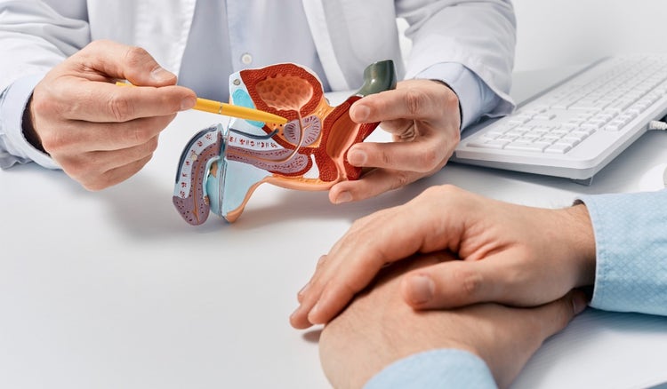 Conoce sobre la Hiperplasia Prostática Benigna
